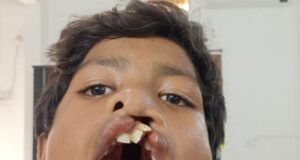 सफलता की कहानी